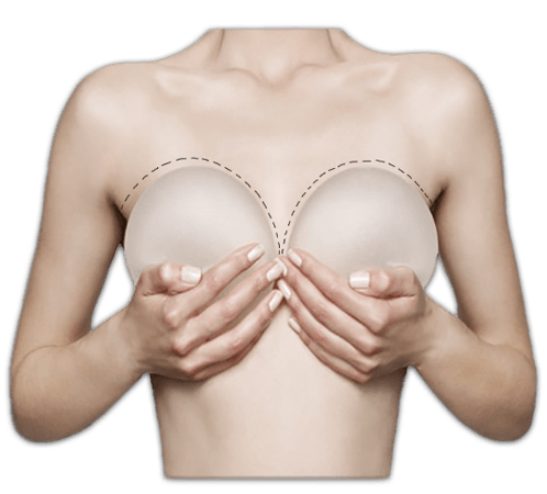 Zvětšení poprsí lze dosáhnout i bez plastiky prsou